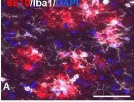 QPS: 6E10/Iba1/DAPI