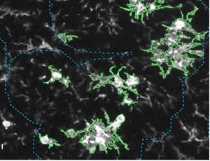 QPS: Final Measurement of Plaque-Associated Microglia