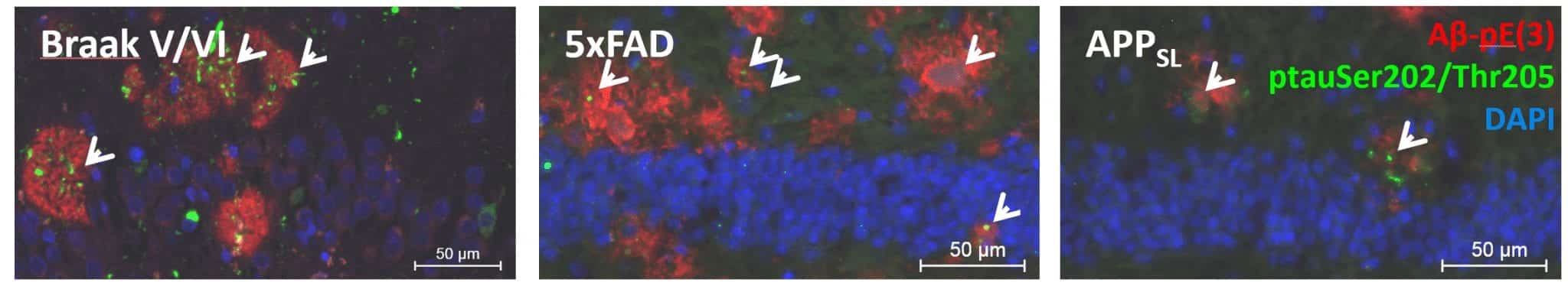 Immunolabeling for pyroglutamate-amyloid