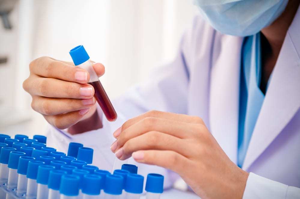 Doctor wearing mask holding blood sample