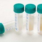 Saliva samples for a laboratory test