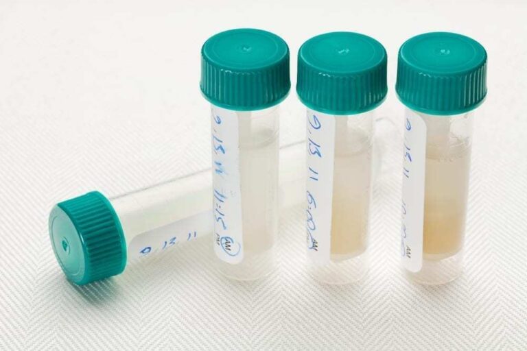 Saliva samples for a laboratory test