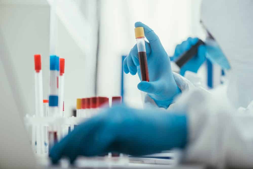 Close-up of biochemist holding test tube with blood sample besides colleagues