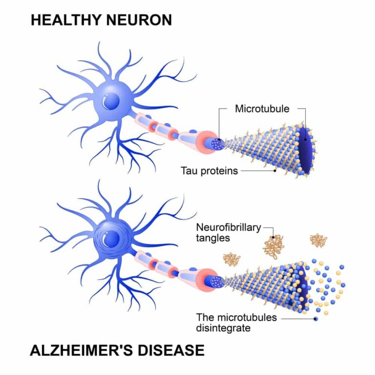 Healthy cell and neurons with AD disease
