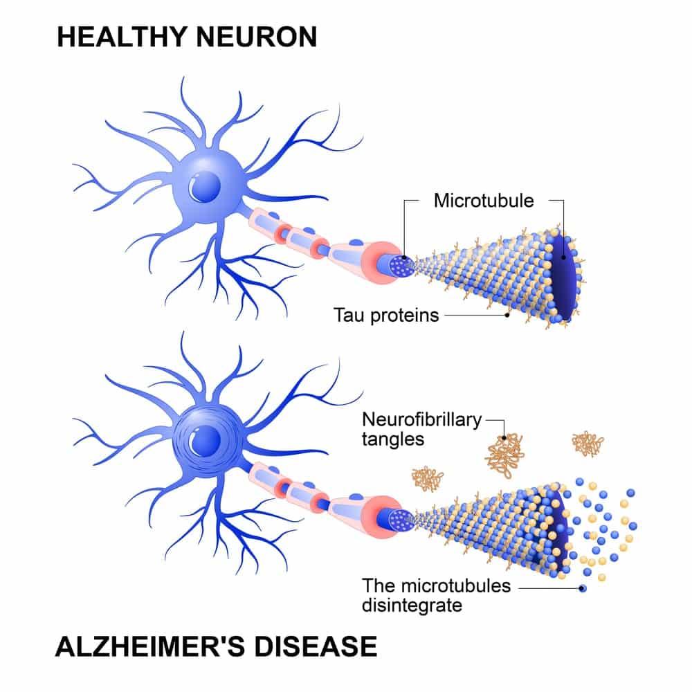 Healthy Neuron