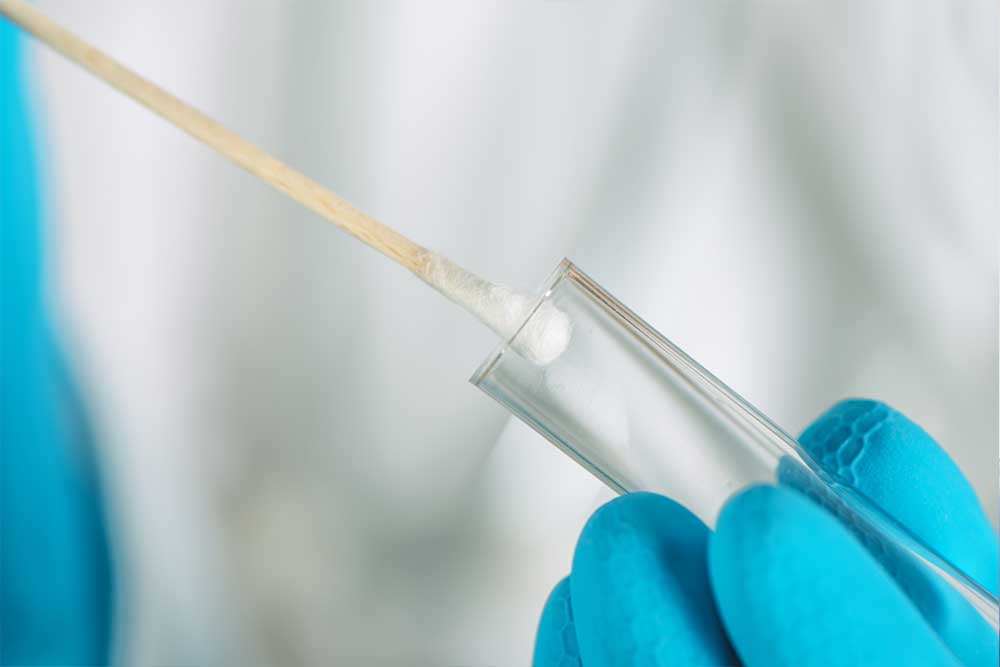 swab