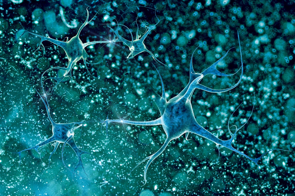 3D illustration of neurons