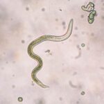Roundworm seen through microscope