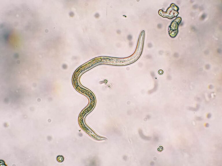 Roundworm seen through microscope