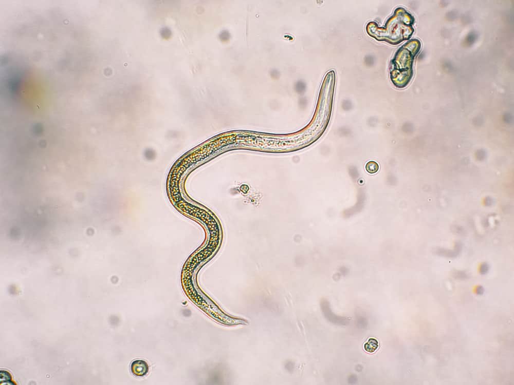 Roundworm seen through microscope