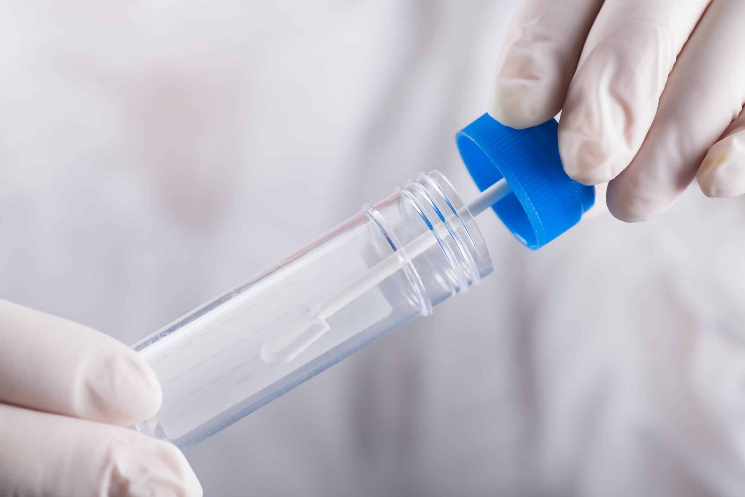 Hands wearing medical gloves holding tube with cap for stool analysis