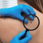 Dermatologist-examining-a-mole-on-the-back-of-a-patient