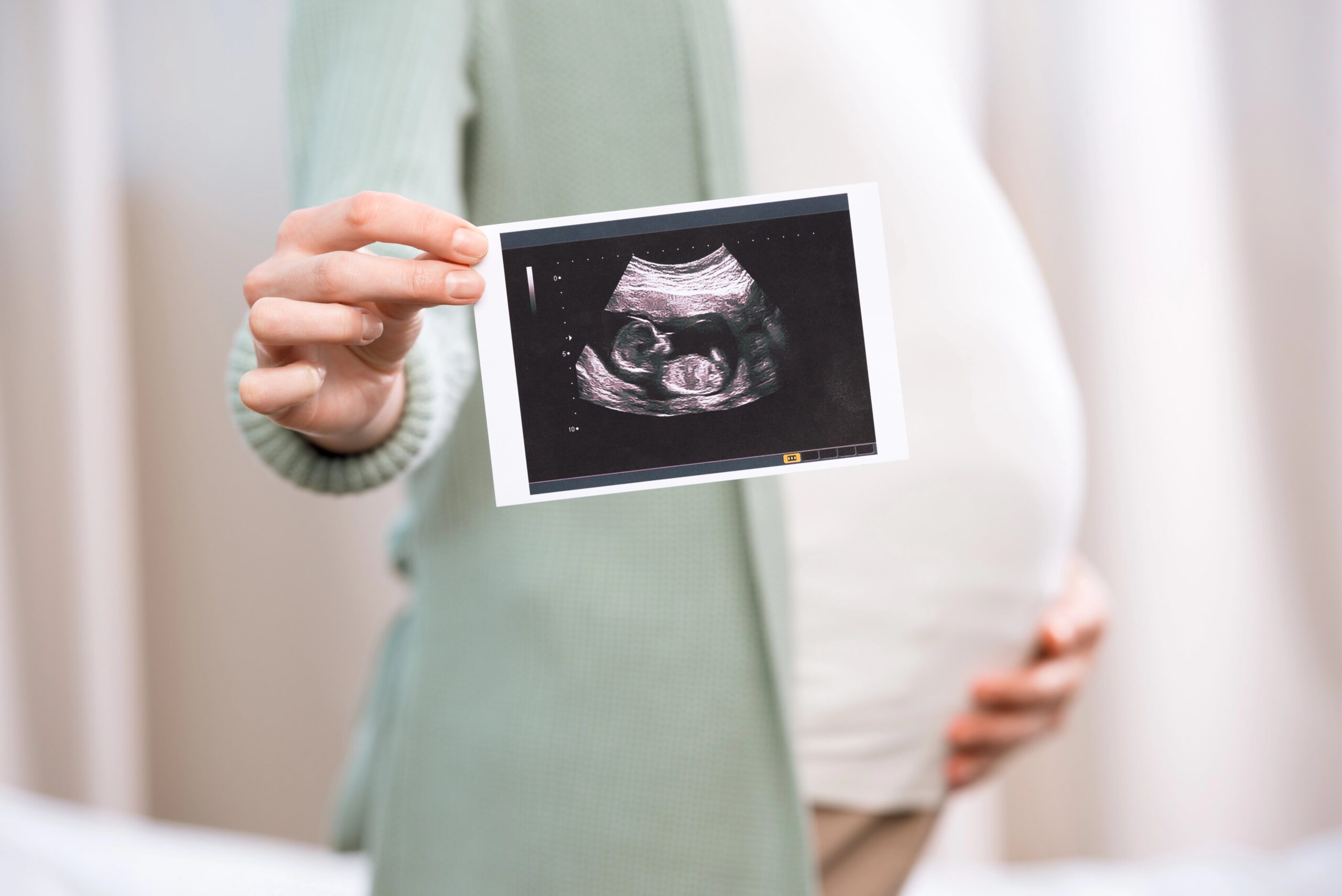 Pregnant woman holding ultrasound photo