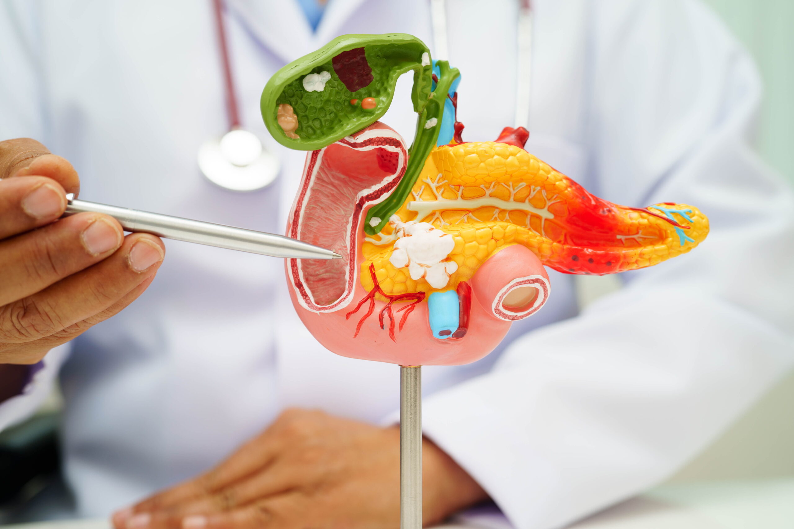 Doctor with pancreas, gallbladder and bile duct human anatomy model