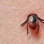 Tick Sucking on Human Skin