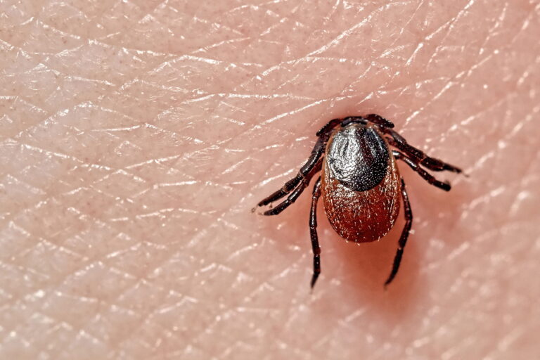 Tick Sucking on Human Skin
