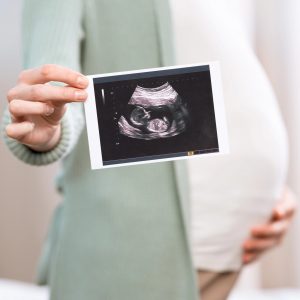 Pregnant woman holding ultrasound photo